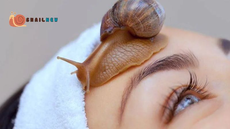 Can Snail Mucin Cause Acne?